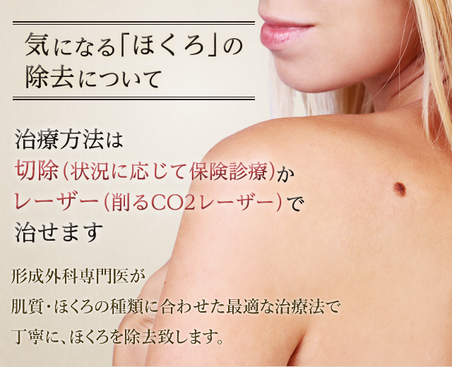 気になる「ほくろ」を簡単除去。治療方法は切除（状況に応じて保険診療）かレーザー（削るCO2レーザーで治せます。形成外科専門医が肌質・ほくろの種類に合わせた最適な治療法で丁寧に、ほくろを除去致します。）