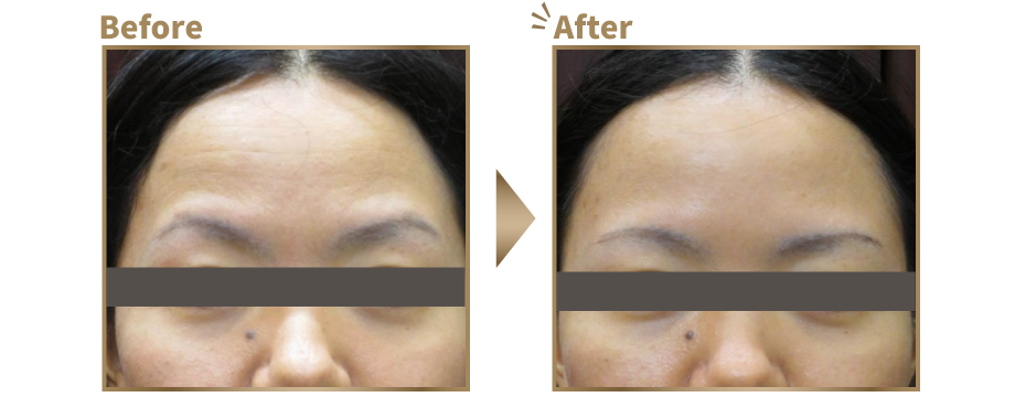 リラックスした状態 ビフォーアフター