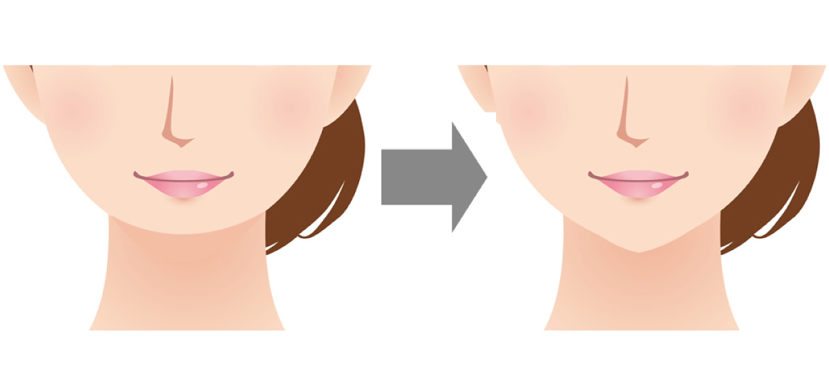 あごをシャープにする