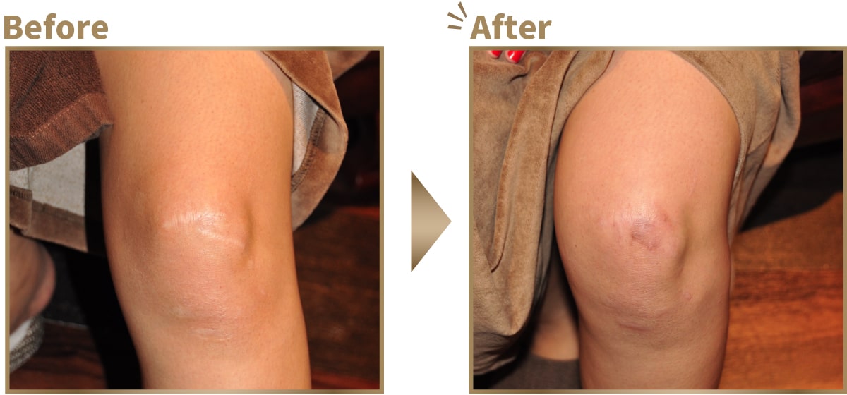 症例写真ビフォーアフター