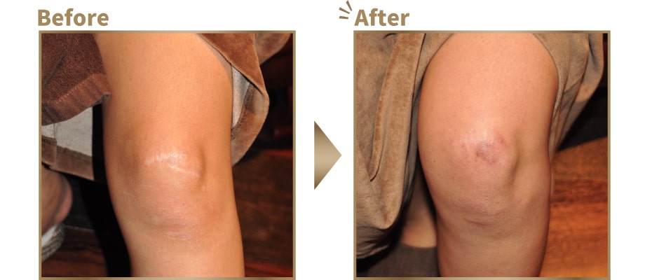 症例写真ビフォーアフター